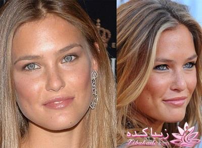 جراحی بینی - جراحی زیبایی